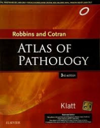 Image of Robbins and Cotran Atlas of Pathology